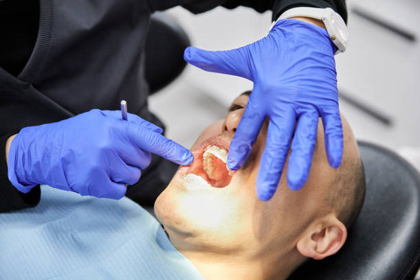 Best Emergency Dental Care for Broken or Chipped Teeth in Lakeland, NY